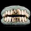 SOLID GOLD GRILLZ (CUSTOM FIT)